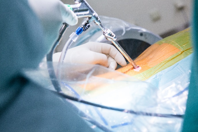 Bandscheibenvorfälle 3 Wir­bel­säu­len­chir­ur­gie