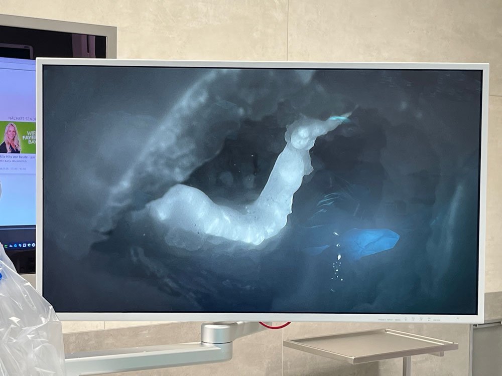 lymphzentrum-behandlung Lymphzentrum Ansicht Minitor